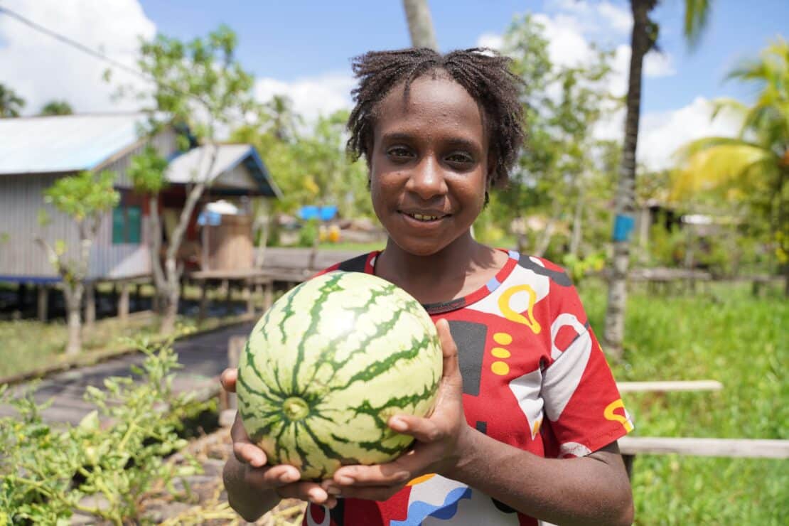bambino tiene in mano un cocomero. tra i benefit che world vision porta c'è anche lo sviluppo delle comunità